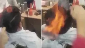 ফায়ার কাট দিতে গিয়ে পুড়লেন যুবক!