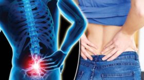 কোমরের ব্যথা দূর করার উপায়