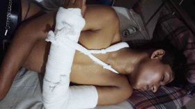 বাউফলে বি‌য়ের অনুষ্ঠা‌নে সালাদ না দেয়ায় বর ক‌নে প‌ক্ষের সংঘ‌র্ষে আহত ১৫