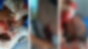 সাগরদীতে ২ শ্যালককে এলোপাতাড়ি কোপালেন আমেরিকা প্রবাসী
