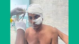 ঢাকার সমাবেশে আহত বাউফলের আইনজীবী জাহাঙ্গীর মৃত্যুর সাথে পাঞ্জা লড়ছেন
