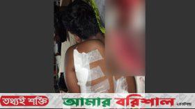 কাঁঠালিয়ায় ব্যবসায়ীর উপর হামলা, পিতা-পুত্রকে কুপিয়ে জখম
