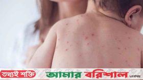 দেশে একদিনে সন্দেহজনক হামে আক্রান্ত ৯৪৭, মৃত্যু ৩