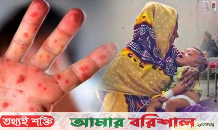 হাম ও উপসর্গে আরও ১০ শিশুর মৃত্যু
