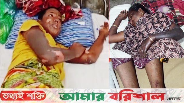 বাকেরগঞ্জে বালুর বস্তায় বোমার বিস্ফোরণ, দগ্ধ ৩
