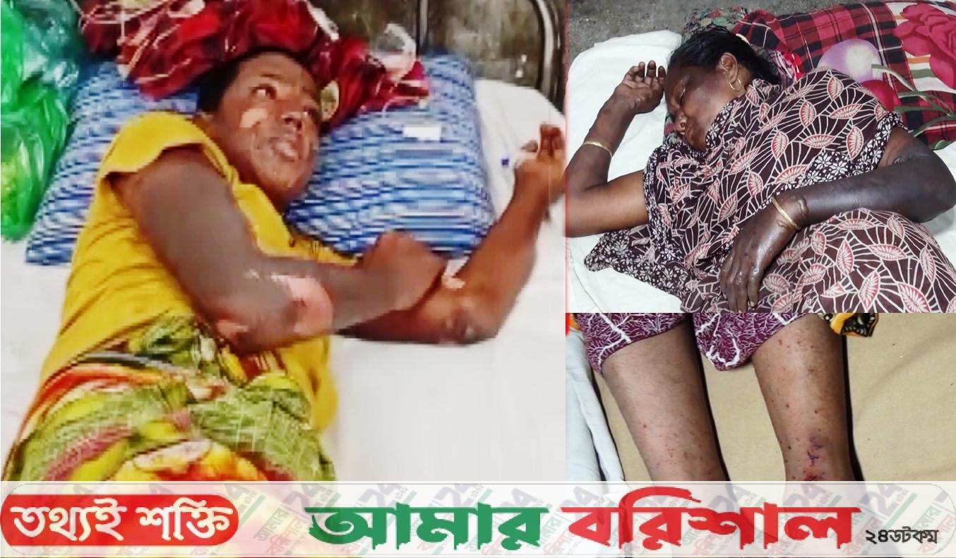 বাকেরগঞ্জে বালুর বস্তায় বোমার বিস্ফোরণ, দগ্ধ ৩